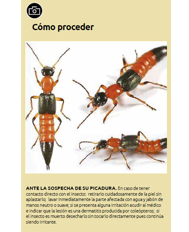 Lesión en la piel provocada por un insecto de verano