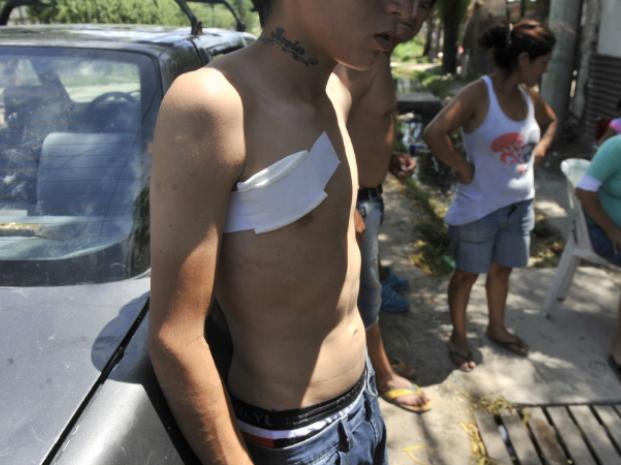 Dos adolescentes fueron baleados en un intento de robo en Empalme Graneros 