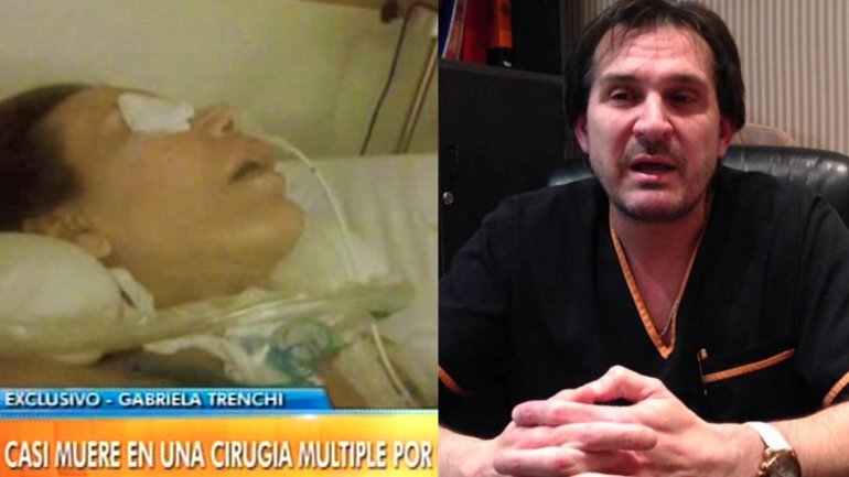 EL RELATO DE LA MUJER QUE CASI MUERTE TRAS OPERARSE CON LOTOCKI