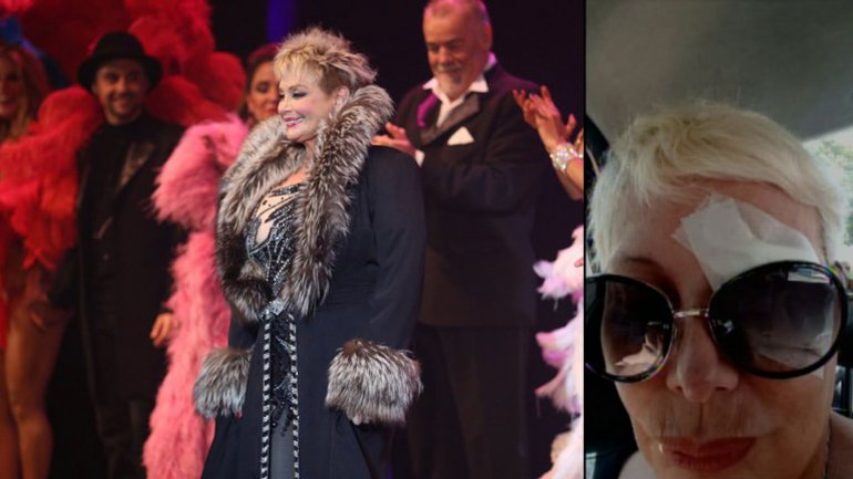 CARMEN BARBIERI, OPERADA DE UN TUMOR BENIGNO