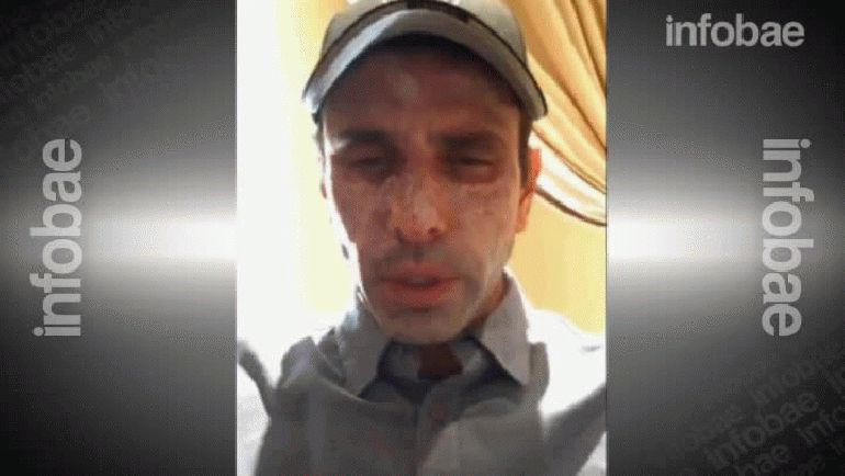 Henrique Capriles reveló el problema de salud que padece