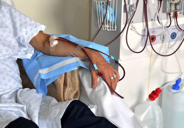 Reconocen contagios de hepatitis en pacientes renales dializados
