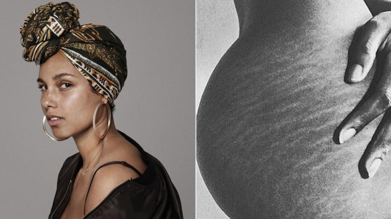 ALICIA KEYS REVOLUCIONÓ LAS REDES CON UNA FOTO DE SUS ESTRÍAS