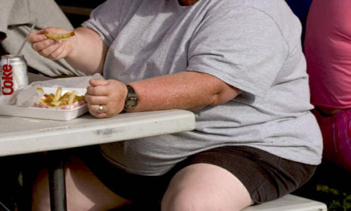 Cuatro personas con obesidad mórbida se atienden por semana