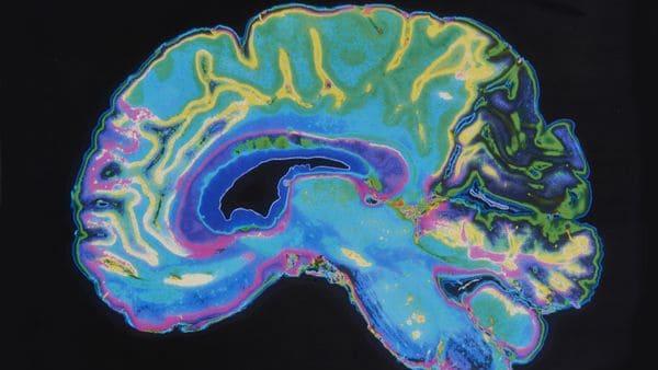Cinco claves para mantener un cerebro activo toda la vida