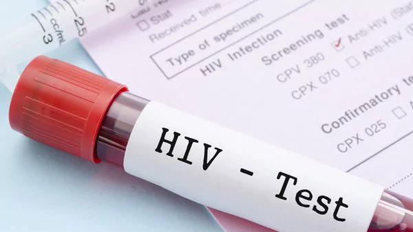 Por primera vez bajaron los casos HIV en EE.UU.