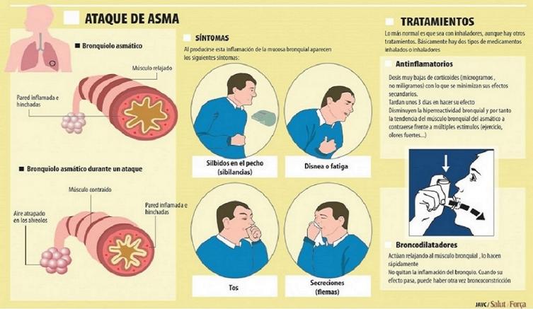 Cómo evitas las crisis de asma