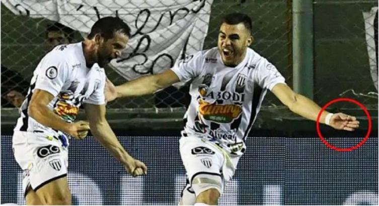 ANTIFÚTBOL: DEFENSOR DE PACÍFICO USÓ AGUJAS CONTRA ESTUDIANTES (audio)