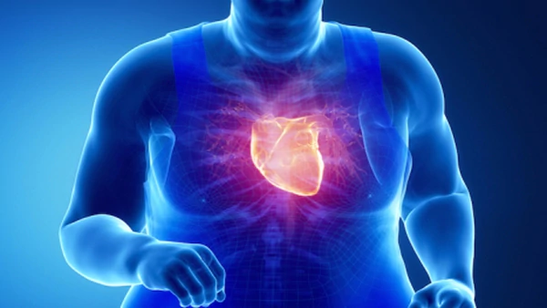 Con la obesidad, el corazón también pierde su figura