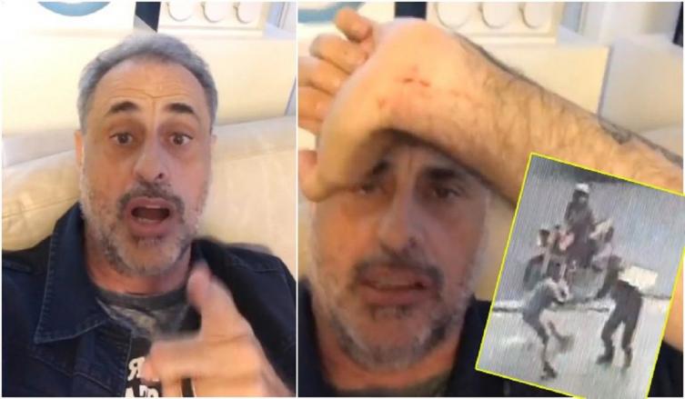 RIAL MOSTRÓ LAS LESIONES QUE LE DEJÓ EL ROBO: 