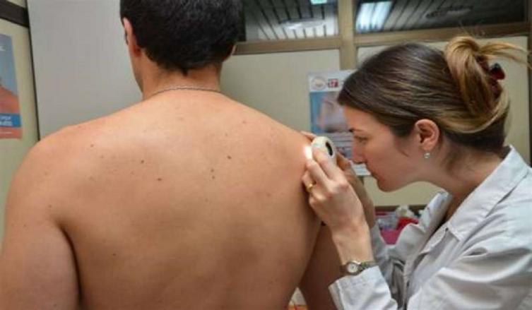 Santa Fe adhiere a la Semana de Prevención del Cáncer de Piel