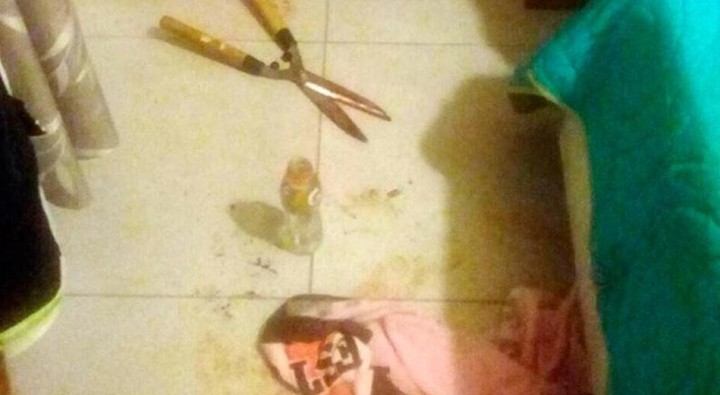 Córdoba: una joven le cortó el pene a su amante mientras dormía