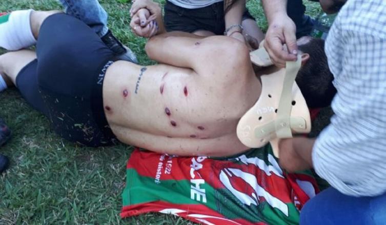 VIOLENTA REPRESIÓN POLICIAL EN UNA LIGA DE LA PROVINCIA DE SANTA FE