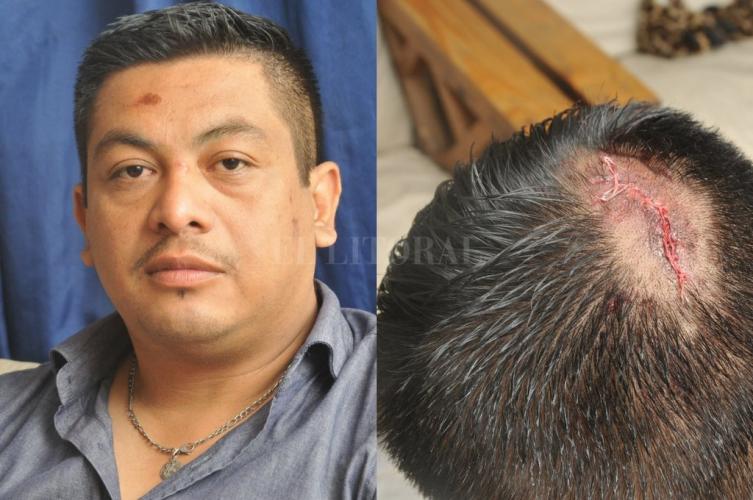 Atropellaron a un policía en un control de alcoholemia