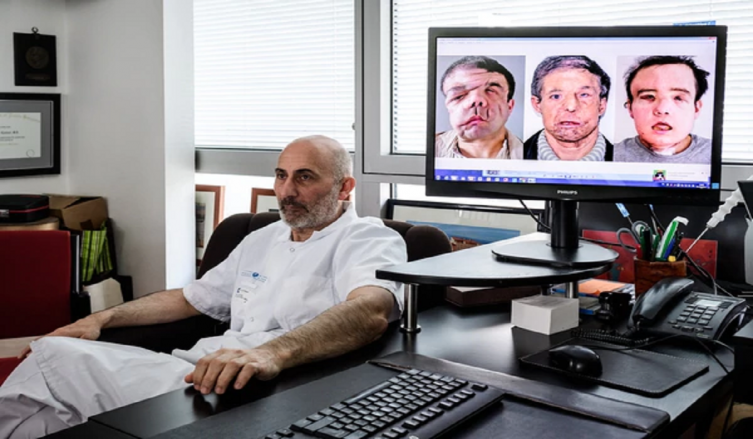 La primera persona en el mundo sometida a dos trasplantes de cara