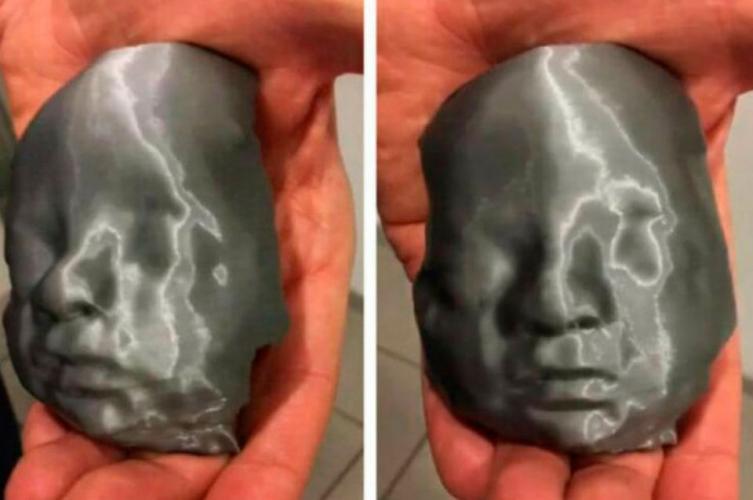 Una pareja de ciegos conoció a su bebé con una ecografía 3D