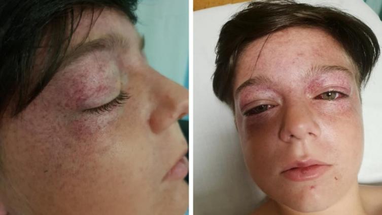 El peligroso desafío de YouTube que le causó graves heridas a un niño de 11 años
