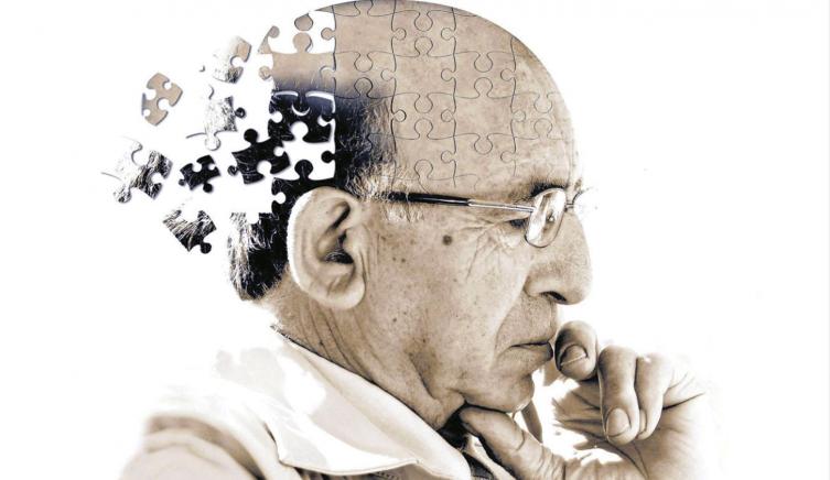 Alzheimer: 