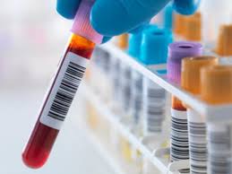 El examen de sangre que te diagnostica si tenés depresión