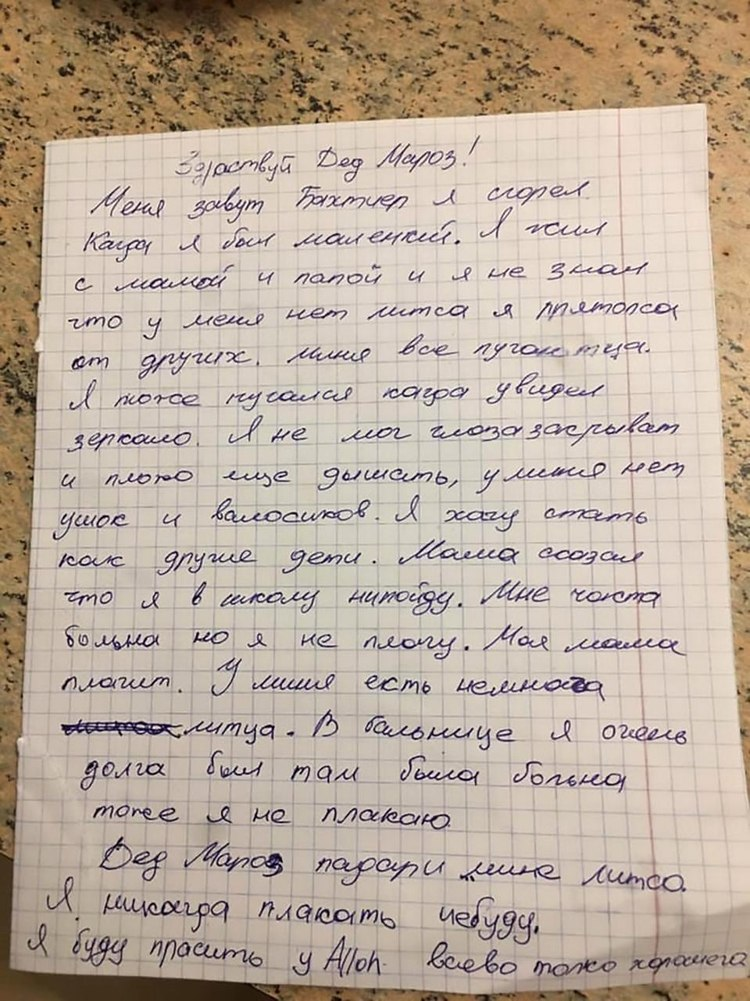 Sobrevivió al incendio de su casa y le pidió a Papá Noel una nueva cara para que la gente 