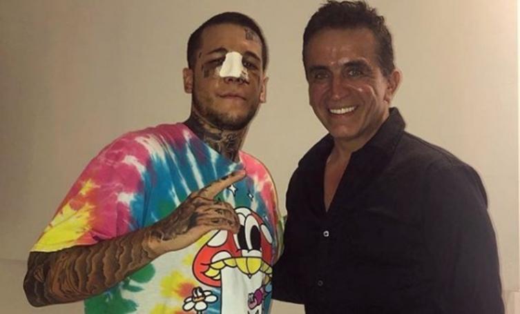 Alexander Caniggia se hizo nariz nueva: ¿a quién se parece?