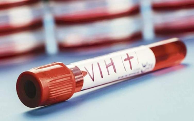Un estudio francés abrió una puerta para eliminar al HIV del organismo