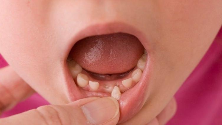 Los dientes de leche podrían salvar vidas