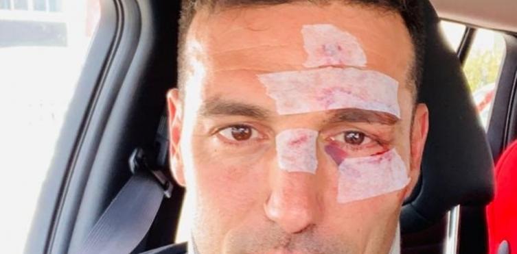 Susto para Lionel Scaloni en España: fue atropellado por un auto 