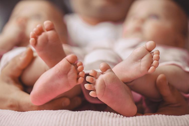 Separaron a dos bebés unidos por la pelvis