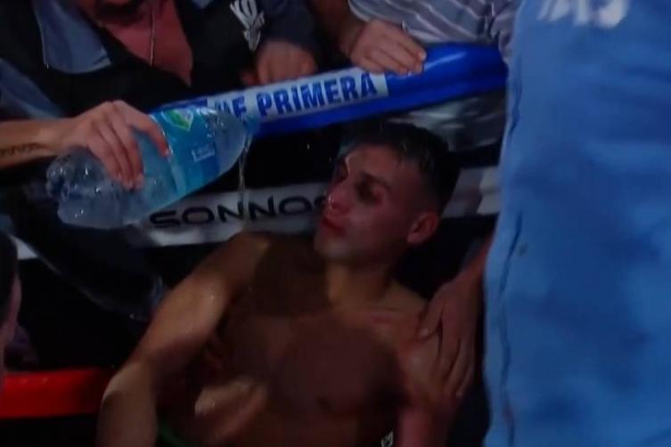 Operaron a Santillan luego de la brutal pelea