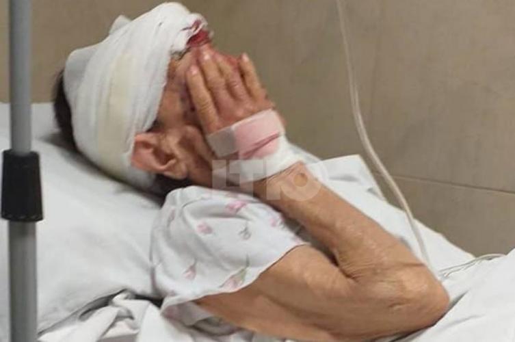 Salvaje ataque a una anciana para robarle pan y un monedero