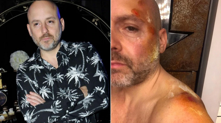 José María Muscari tuvo un accidente vial y sufrió fuertes lesiones