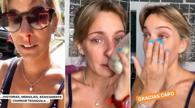 Golpearon fuertemente a Dani La Chepi para robarle el celular