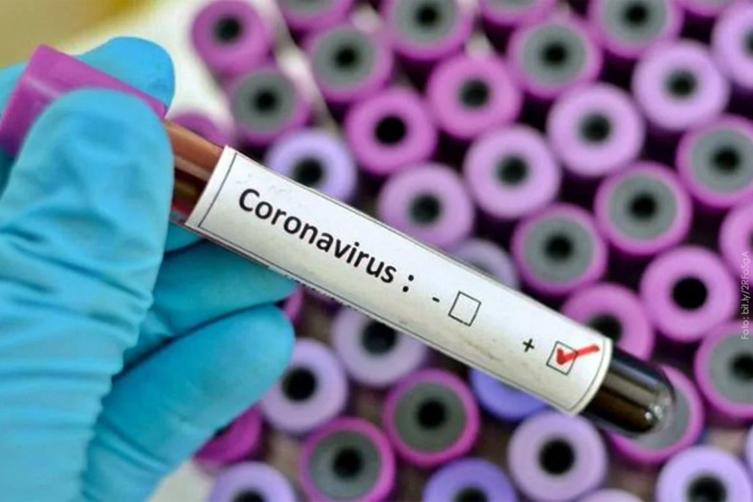 Confirmaron otros 9 casos en la Argentina de coronavirus y  ascienden a 65