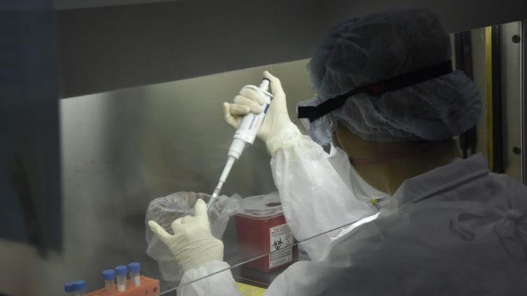 Confirmaron otros 30 casos en el país y suman 158 infectados