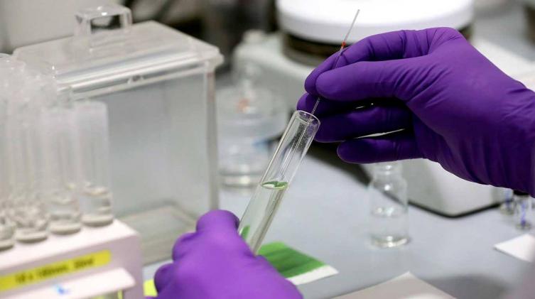 El Instituto Malbrán analiza unas 300 muestras diarias