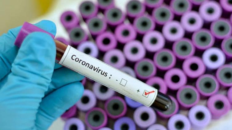  22 casos nuevos de COVID-19 en la Provincia de Santa Fe