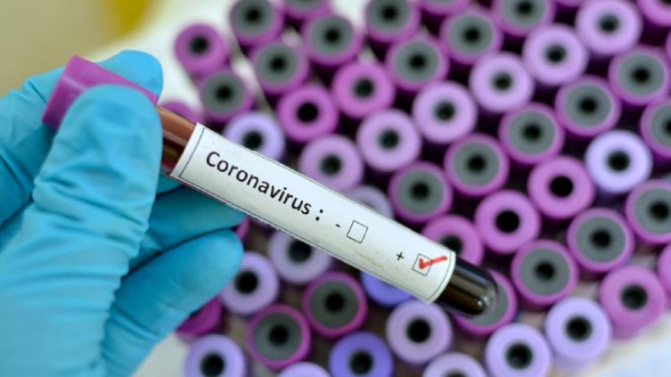 Siete nuevos casos de coronavirus en Santa Fe