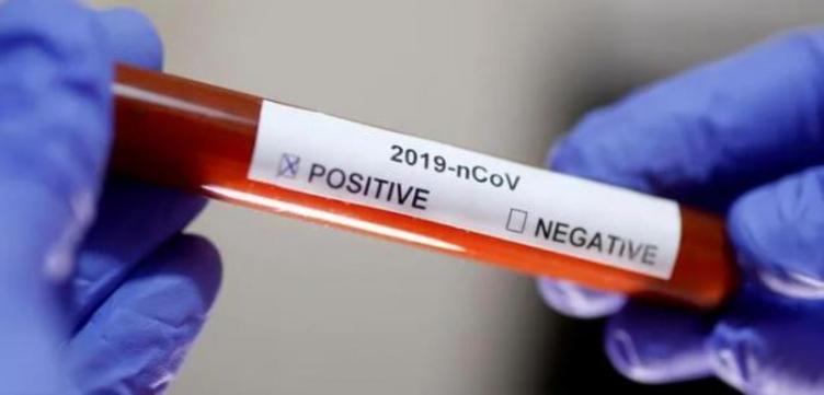 Son 229 los muertos por coronavirus en el país