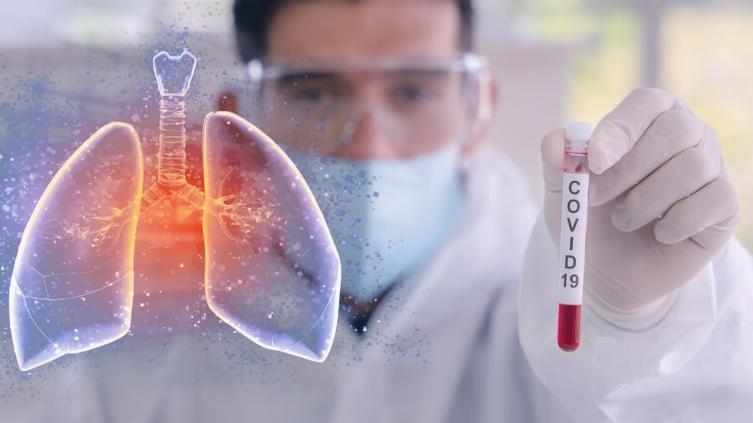 13 nuevos casos de coronavirus en Santa Fe