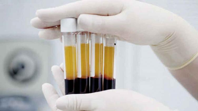 125 pacientes recuperados de Covid se anotaron para donar plasma