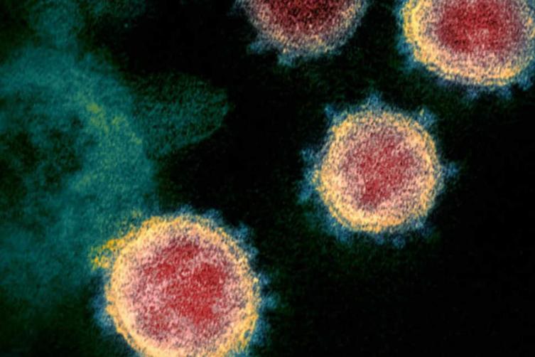 Coronavirus: Un nuevo caso registrado en Santa Fe