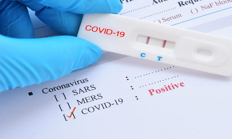 Se reportaron 21 nuevos casos de covid-19 en la provincia: uno en la ciudad de Santa Fe