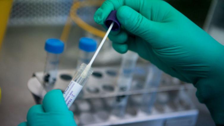 Coronavirus: 34 nuevos casos en Santa Fe