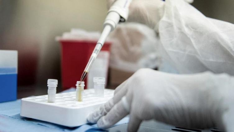 Coronavirus: La Anmat aprobó ensayos clínicos con suero de caballos 
