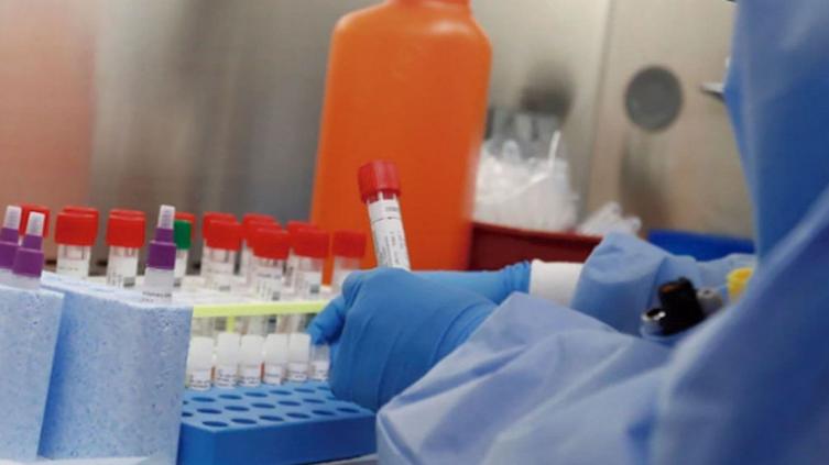 Récord de positivos en Santa Fe con 63 nuevos casos de Covid-19