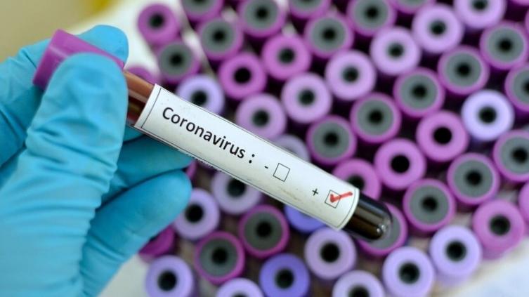Récord: 68 nuevos casos de coronavirus en Santa Fe