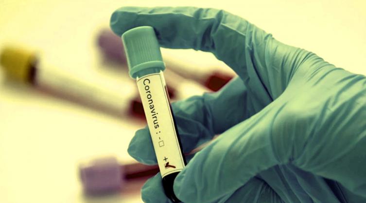 Santa Fe: 52 nuevos casos de coronavirus en la provincia