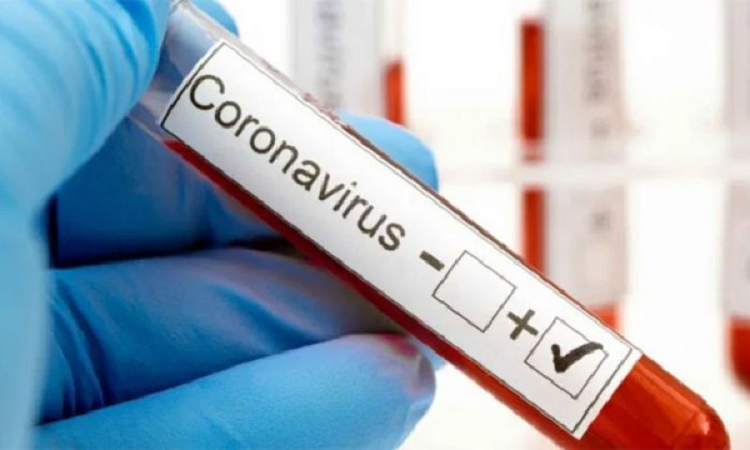 Récord de casos positivos de Covid-19 en la provincia
