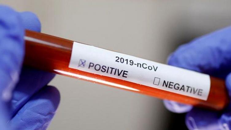 Cinco nuevas muertes por coronavirus en Santa Fe
